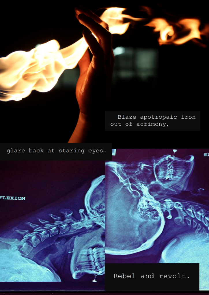                                Blaze apotropaic iron
out of acrimony, glare back at staring eyes.
Rebel and revolt. 

[image: a hand passing through flame; an x-ray of Robin’s cervical spine in flexion and extension, where their lip piercing is visible]
